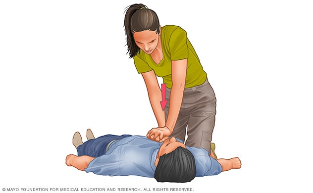 PRIMERO AUXILIOS Y REANIMACIÓN CARDIOPULMONAR